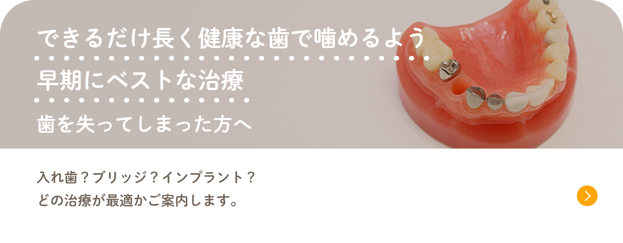 できるだけ長く健康な歯で噛めるよう早期にベストな治療 歯を失ってしまった方へ 入れ歯?ブリッジ?インプラント?どの治療が最適かご案内します。